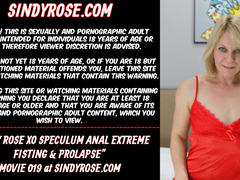 Sindy Rose XO speculum anal extreme fisting & prolapse